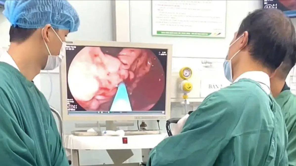 Nguy kịch v&igrave; vỡ gi&atilde;n tĩnh mạch do xuất huyết ti&ecirc;u ho&aacute;