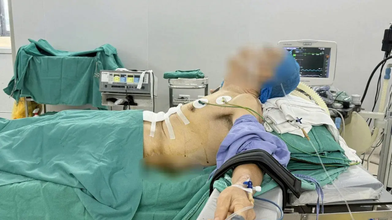 Phẫu thuật ung thư dạ d&agrave;y cho bệnh nh&acirc;n g&ugrave; vẹo cột sống