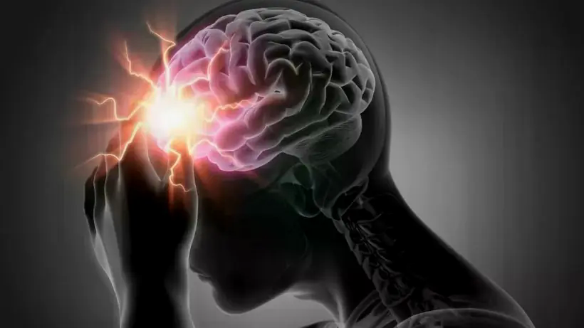 Hiểu đ&uacute;ng về đột tử v&agrave; đột quỵ