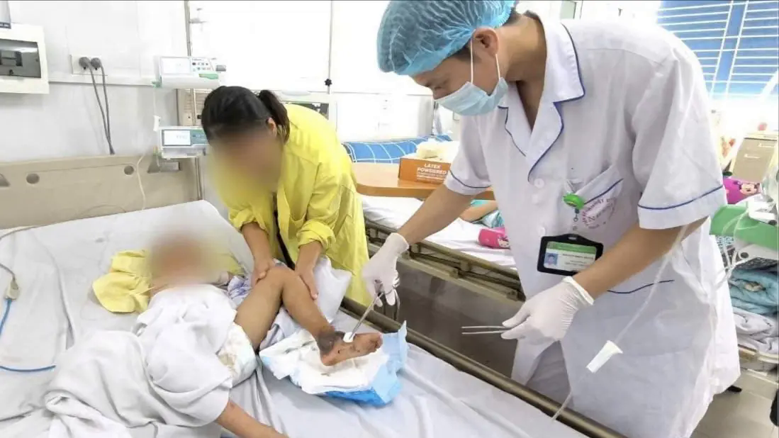 B&eacute; trai nguy kịch do đắp thuốc nam chữa m&egrave;o cắn
