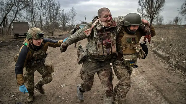 Nga b&agrave;n giao 23 t&ugrave; binh Ukraine bị thương nặng cho Kiev