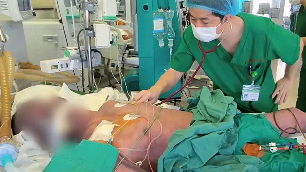 Người đ&agrave;n &ocirc;ng nguy kịch sau khi ăn l&ograve;ng lợn