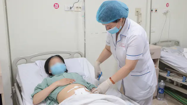 Cứu sống bệnh nh&acirc;n bị vi&ecirc;m ph&uacute;c mạc do vỡ ruột thừa