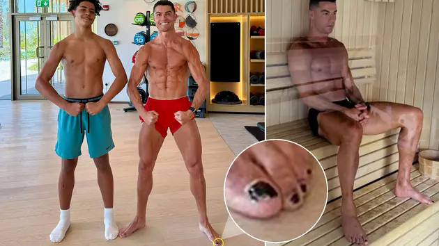 Cristiano Ronaldo sơn m&oacute;ng ch&acirc;n
