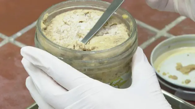 Thanh ni&ecirc;n bị ngộ độc nặng sau khi ăn pate đ&oacute;ng hộp