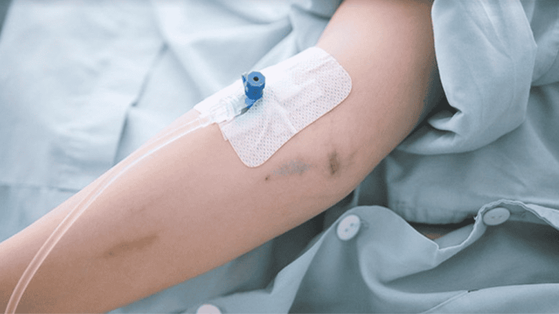 Không tự ý truyền dịch tại nhà khi mắc sốt xuất huyết