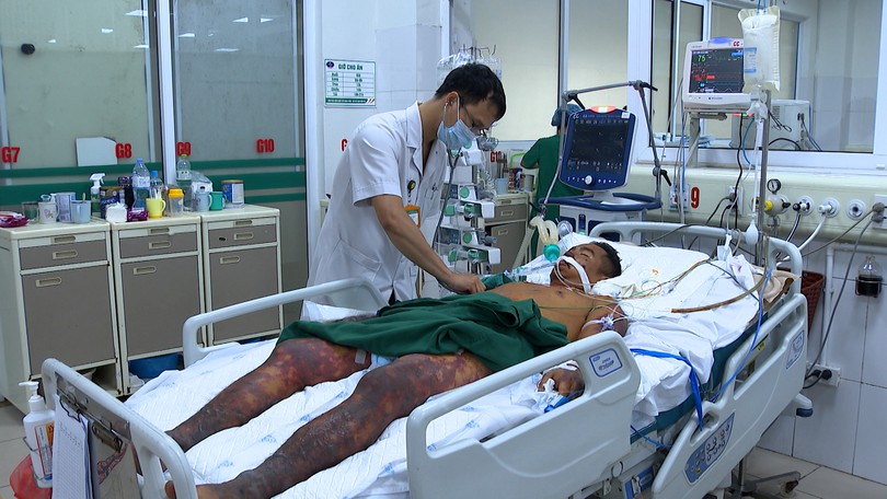 Nguy kịch vì mắc liên cầu lợn sau khi ăn tiết canh