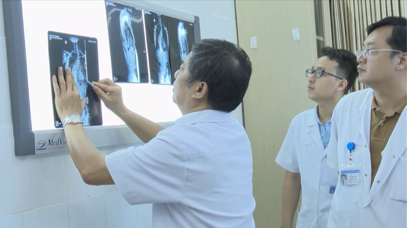 Khoảng 80% trẻ cong vẹo cột sống không rõ nguyên nhân