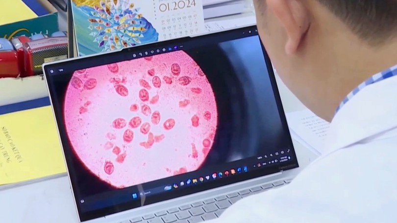 Nhiễm giun sán từ thú cưng