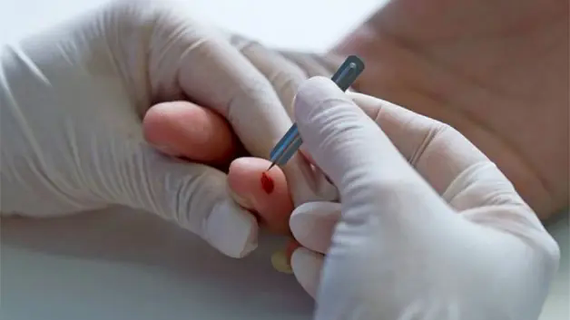 Có nên chích máu đầu ngón tay khi bị đột quỵ?