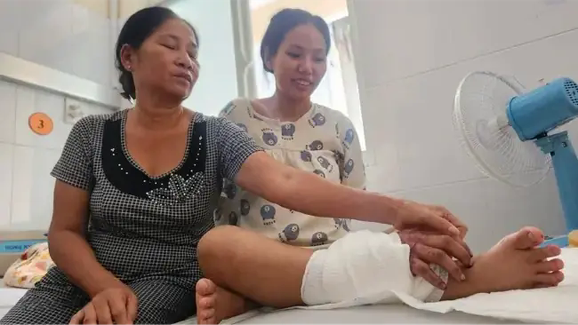 Ghép tạm bàn tay vào cẳng chân cho thai phụ, chờ nối lại