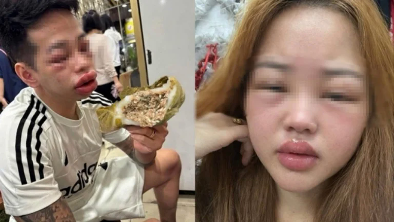 Thói quen dễ dãi với thực phẩm
