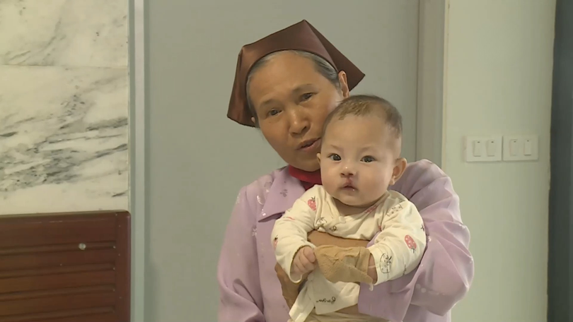 Mang lại nụ cười cho trẻ dị tật vùng hàm mặt