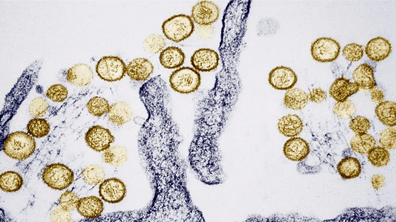 WHO đánh giá rủi ro lây lan virus Hanta
