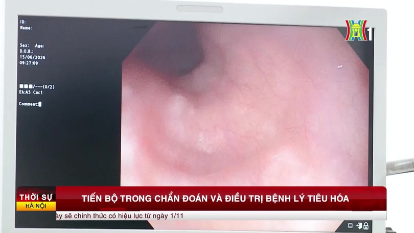 Tiến bộ trong chẩn đoán và điều trị bệnh lý tiêu hóa