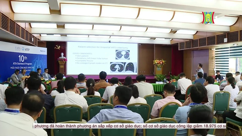 Phát hiện sớm nốt phổi nhỏ, tăng cơ hội điều trị ung thư