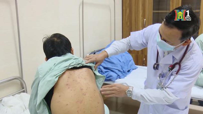 Chủ động phòng chống bệnh viêm đường hô hấp cho trẻ | Sức khỏe cộng đồng | 30/03/2024