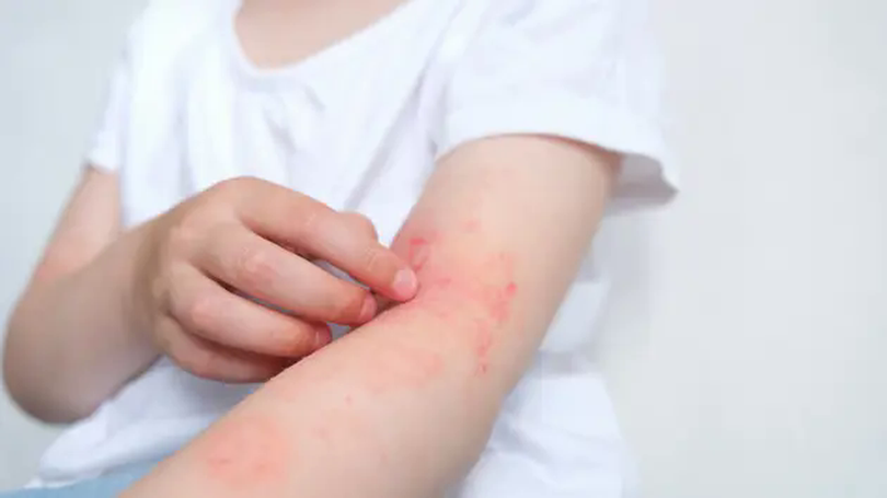Tăng mạnh ca nhiễm ký sinh trùng từ thú cưng