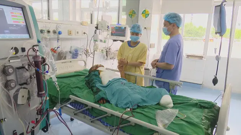 Cảnh báo thực trạng bỏng điện cao thế