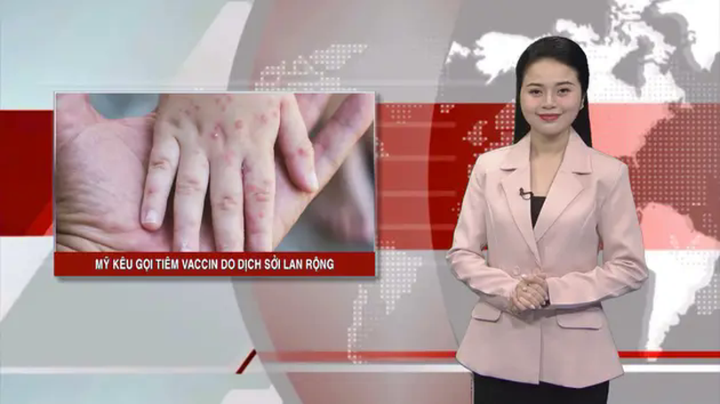 Mỹ kêu gọi tiêm vaccine do dịch sởi lan rộng | Nhìn ra thế giới | 12/04/2025