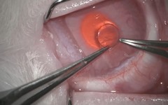 Tây Ban Nha: Phát triển giác mạc nhân tạo từ vảy cá
