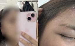 Người phụ nữ tố chồng hành hung dã man tại chung cư