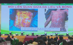 Cập nhật nhiều kỹ thuật mới trong điều trị da liễu, bỏng