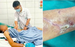 Suýt mất mạng vì chủ quan với vết thương ngoài da