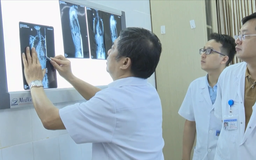 Khoảng 80% trẻ cong vẹo cột sống không rõ nguyên nhân