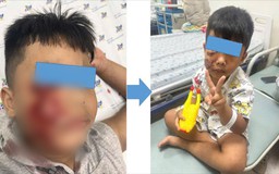 Cấp cứu bé trai 5 tuổi bị chó tấn công