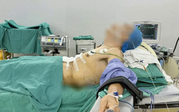Phẫu thuật ung thư dạ dày cho bệnh nhân gù vẹo cột sống