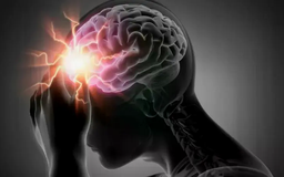 Hiểu đúng về đột tử và đột quỵ