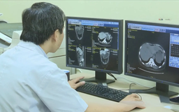 Bệnh án điện tử liệu có về đích đúng hạn?