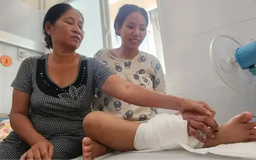 Ghép tạm bàn tay vào cẳng chân cho thai phụ, chờ nối lại