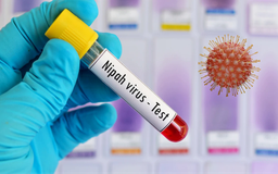 Chủ động nhưng không hoang mang trong phòng bệnh do virus Nipah