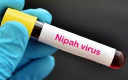 Bộ Y tế ban hành hướng dẫn phòng, chống virus Nipah