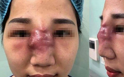 Mỗi năm Việt Nam có 25.000-35.000 ca biến chứng thẩm mỹ