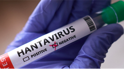 Canada xác nhận ca bệnh đầu tiên nhiễm virus Hanta