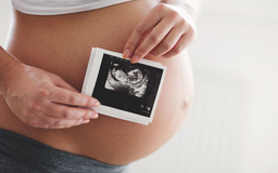 Phạt tới 30 triệu đồng nếu lựa chọn giới tính thai nhi