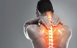 Hướng tới quản lý toàn diện bệnh xương khớp