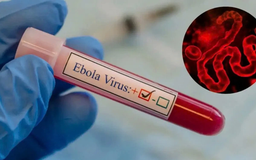WHO kêu gọi giám sát Ebola toàn cầu