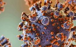 Bộ Y tế lên tiếng về virus Hanta sau chùm ca tử vong trên tàu du lịch nước ngoài