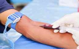 Hà Nội sàng lọc bệnh tan máu bẩm sinh trong cộng đồng