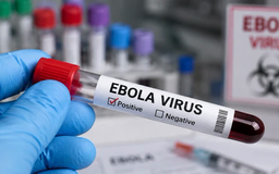Chạy đua phát triển vaccine ngăn chặn Ebola chủng hiếm tại châu Phi