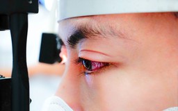 Bệnh đau mắt đỏ gia tăng, Bộ Y tế đưa ra 7 cảnh báo