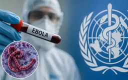 Dịch Ebola tại CHDC Congo lan rộng, số ca tử vong tăng cao