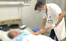 Người cao tuổi cần cảnh giác tổn thương nặng do chó cắn