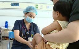 Số ca mắc tay chân miệng tăng gấp 2,5 lần so với năm 2025