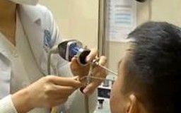 Hi hữu, người đàn ông bị hóc xương cá ở cổ tai