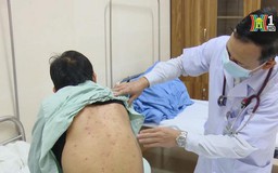 Chủ động phòng chống bệnh viêm đường hô hấp cho trẻ | Sức khỏe cộng đồng | 30/03/2024